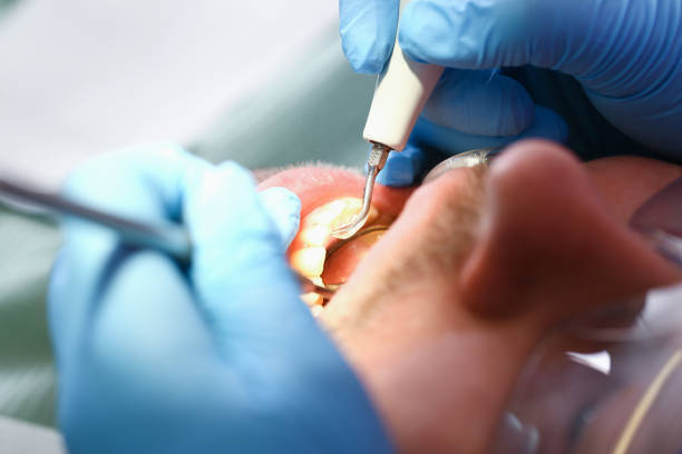 Best Emergency Treatment for Oral Infections in Elsa, TX